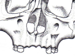 Carton Corry Skull, View A